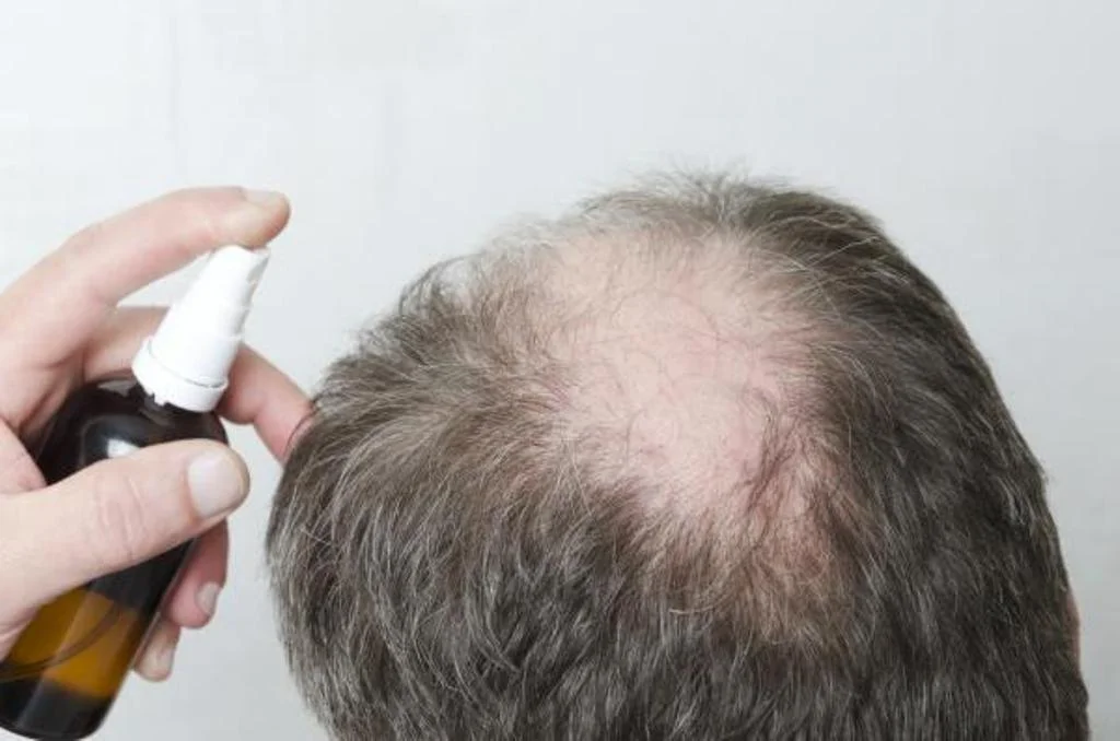 Minoxidil