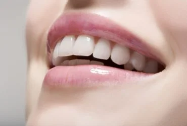 Teeth 2