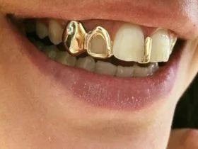 Teeth Grillz 1