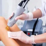 Hair Removal